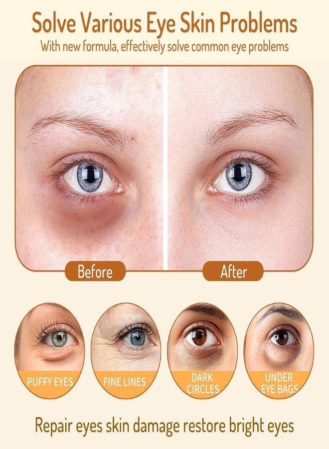 AOAO Roller Ball Eye Serum with Collagen & Caffeine for Puffy Bags Fine Lines Dark Circles Wrinkles, Firming & Hydration, Under Eye Cream with 360° Roller Massage Ball, 15ml/0.5fl.oz (1pack) - Image 5